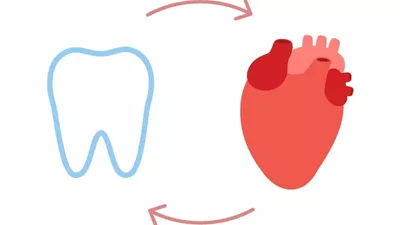 تأثير الأسنان على صحة القلب. هل 